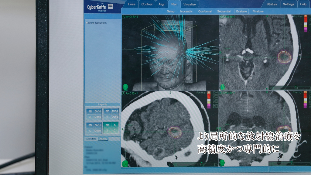 より局所的な放射線治療を高精度かつ専門的に
