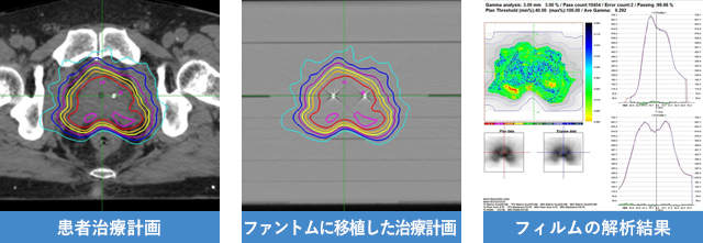 線量分布検証の流れ